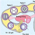 Chửa ngoài tử cung chưa vỡ