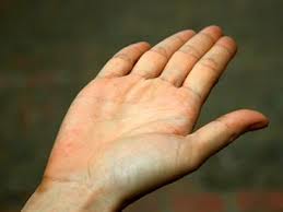 Chẩn đoán bệnh qua hình dáng của bàn tay
